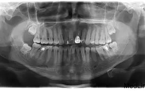 i噿PsI``驔S?}')o7旞颏QY灴熷*滤KB?4步慭還u??V`的简单介绍